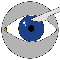 Cura Administrators Cataract surgery icon